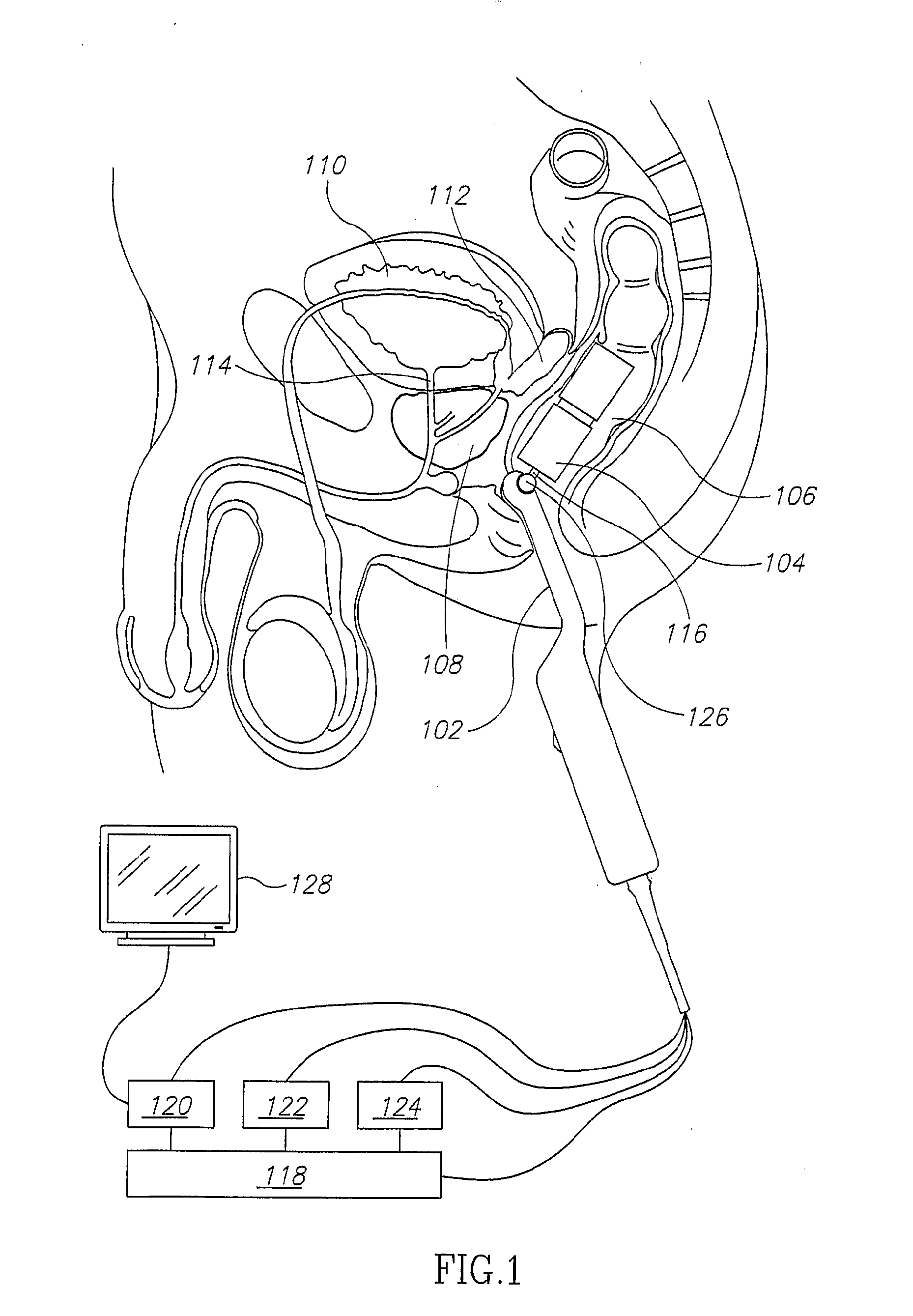 Mri Probe for Prostate Imaging