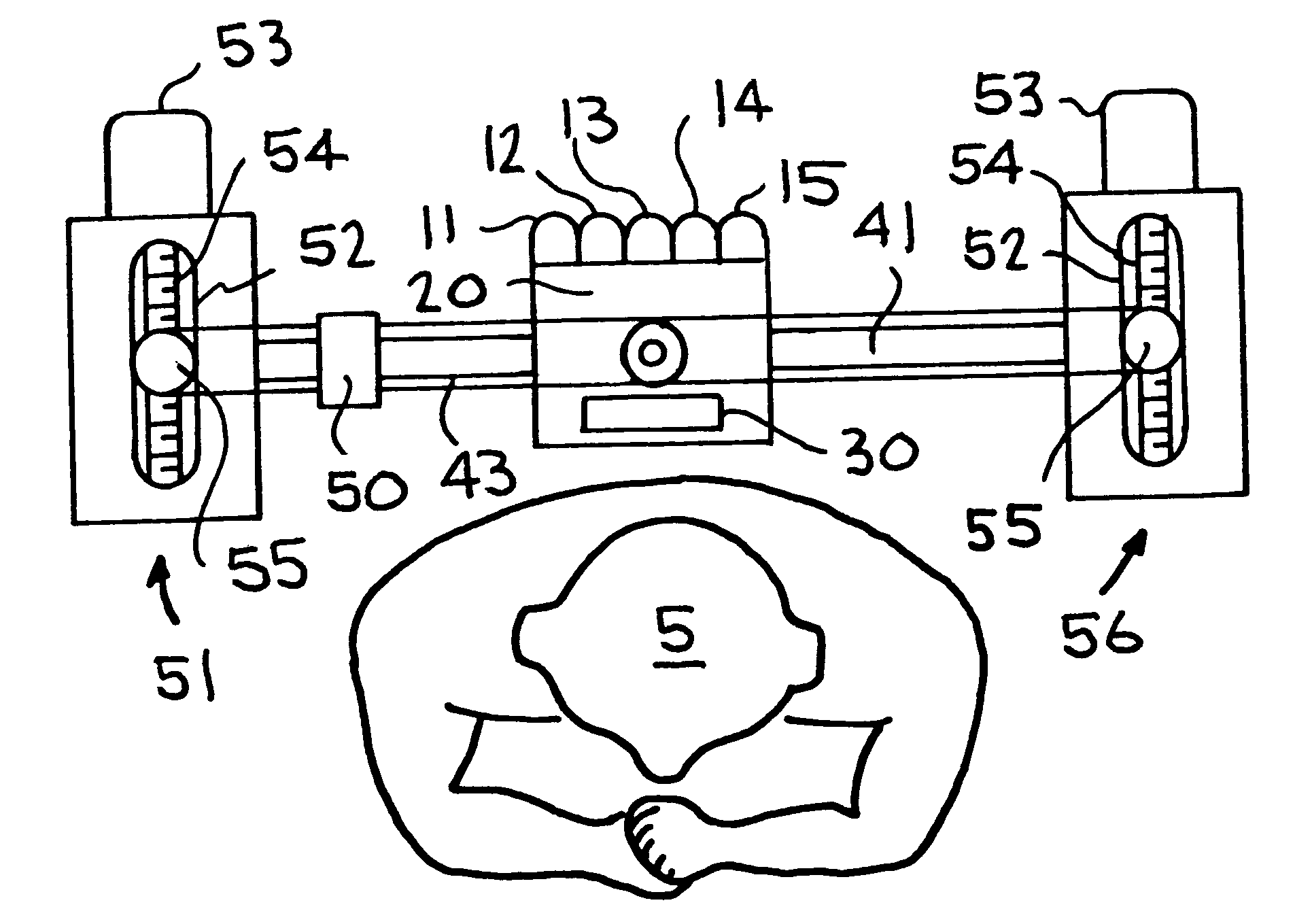 Skin decoration apparatus and method