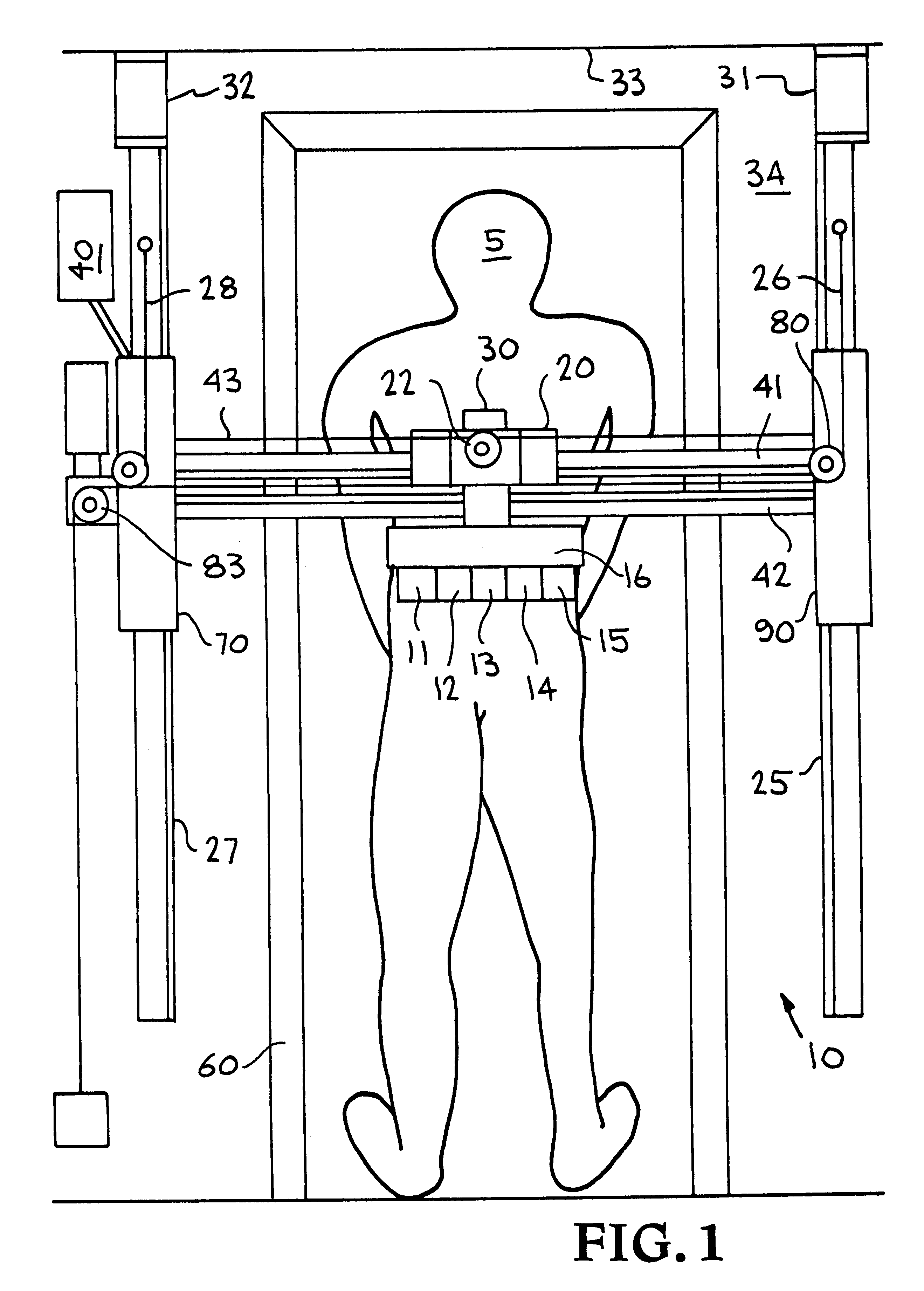 Skin decoration apparatus and method