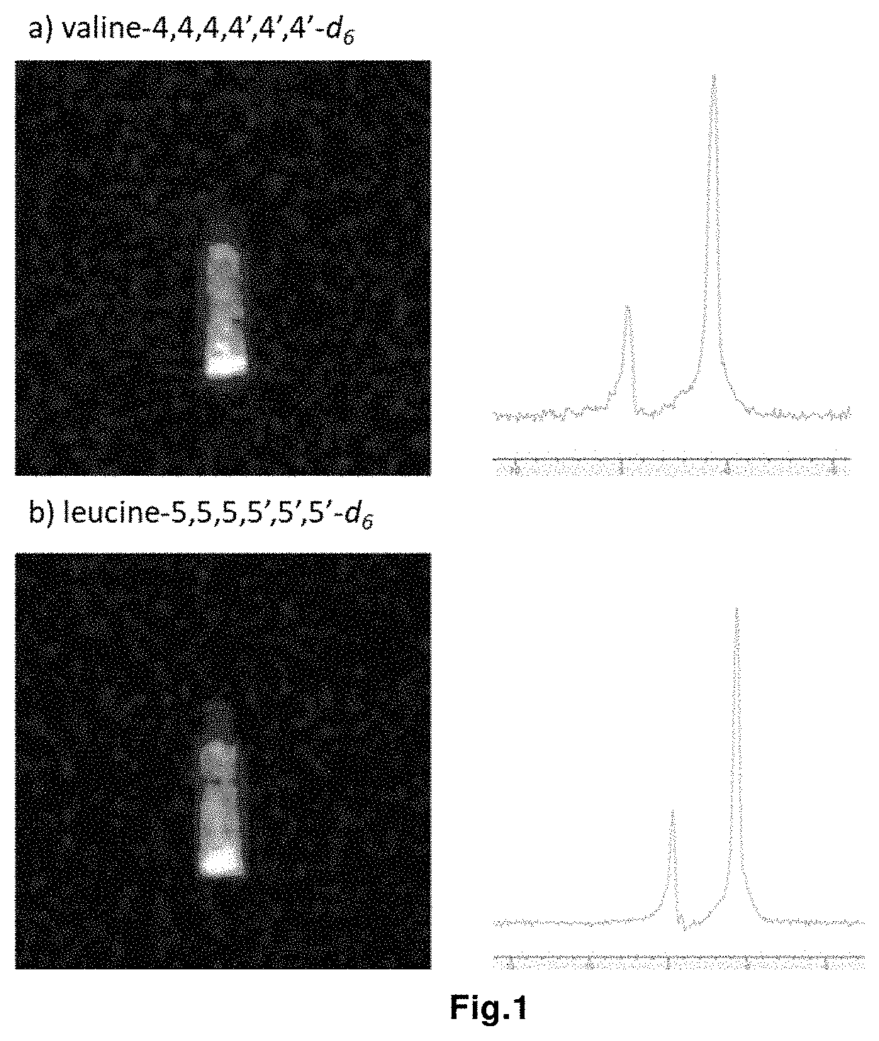 Magnetic resonance imaging drug containing a deuterated natural branched-chain amino acid, and diagnostic method using said drug