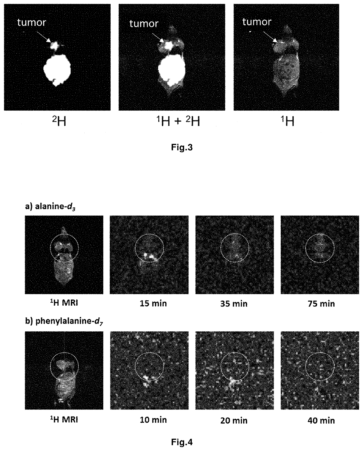 Magnetic resonance imaging drug containing a deuterated natural branched-chain amino acid, and diagnostic method using said drug