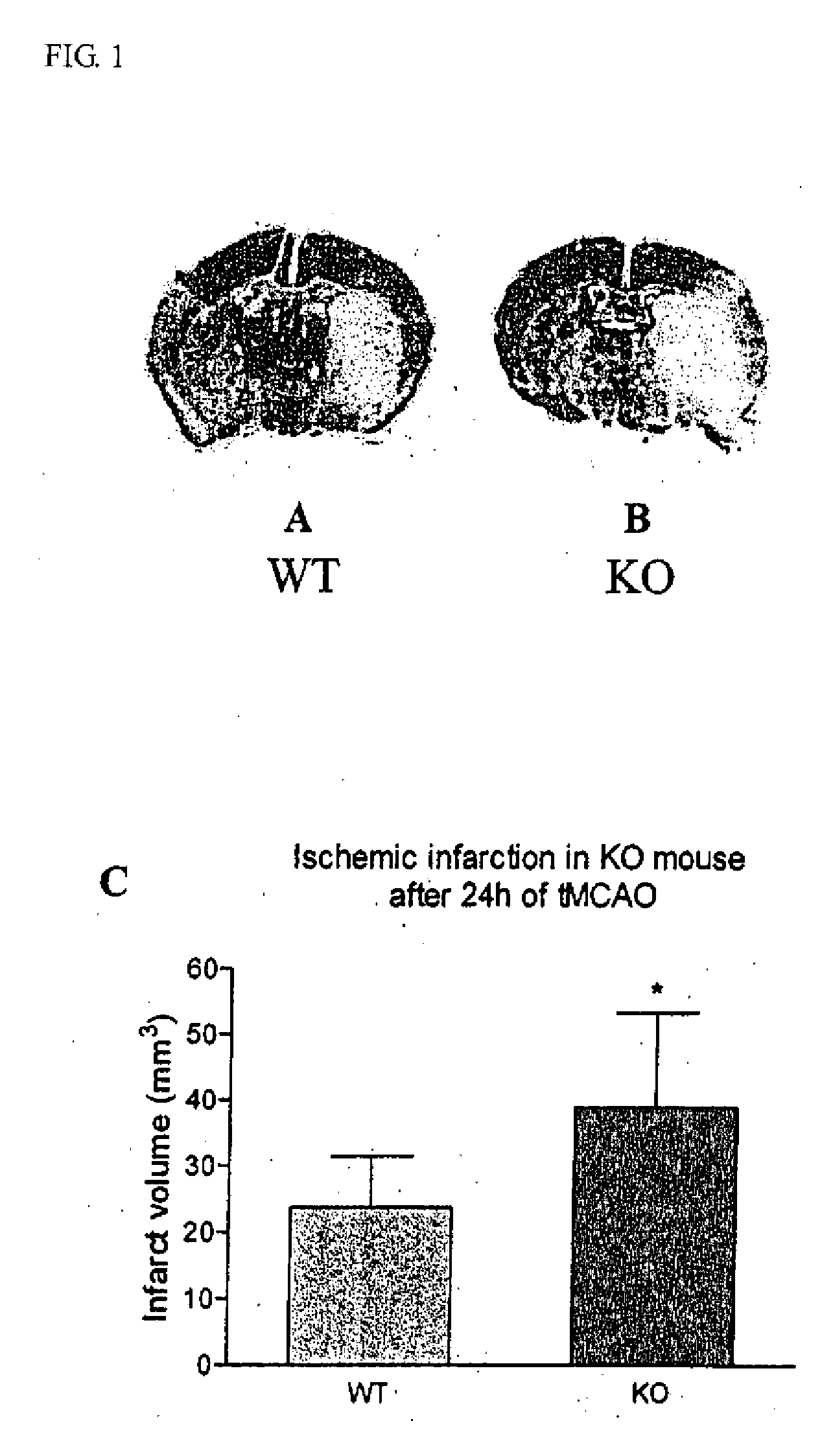 Method of preventing and treating brain infarction