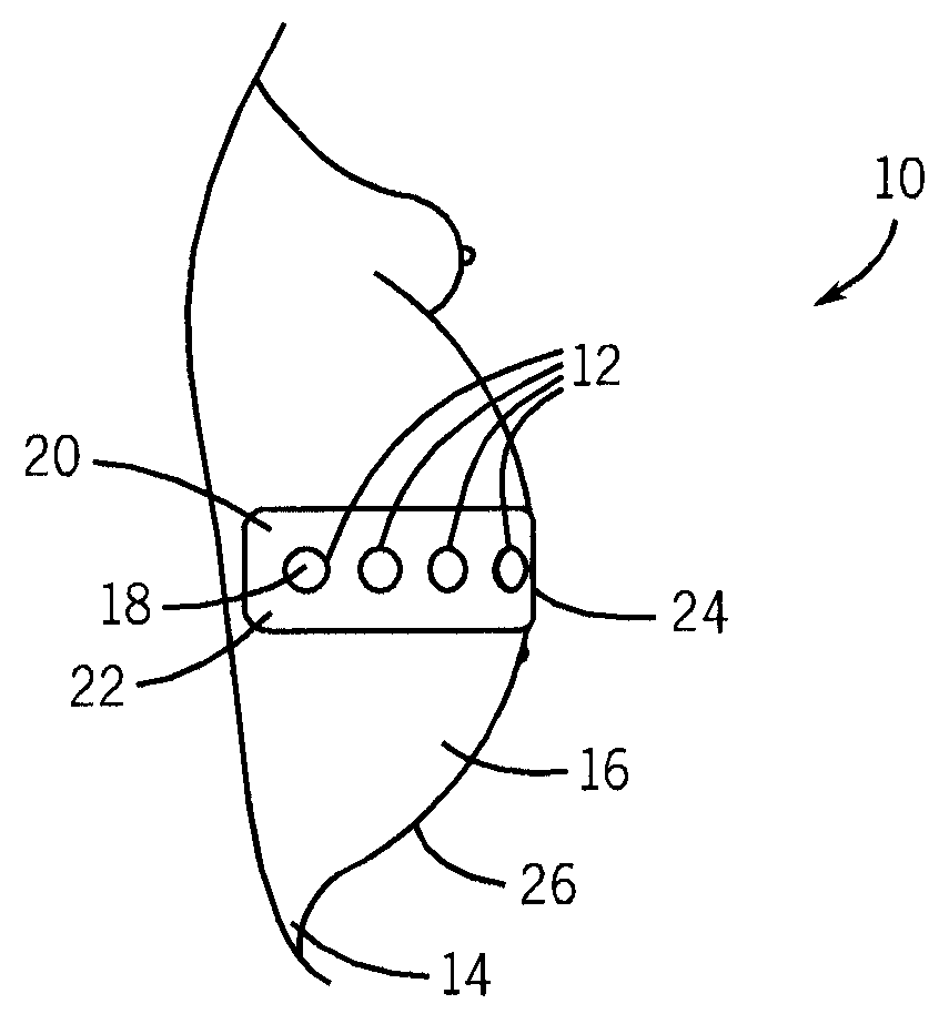 Maternal and fetal monitor ultrasound transducer