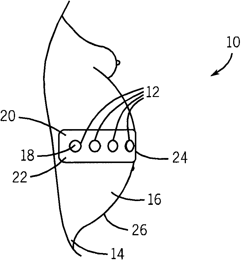 Maternal and fetal monitor ultrasound transducer