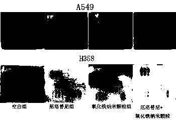 Application of Iron Oxide Nanoparticles in the Preparation of Drugs for Improving Erlotinib Resistance