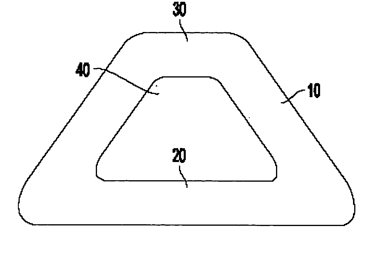 Medical implant and method of reducing back pain