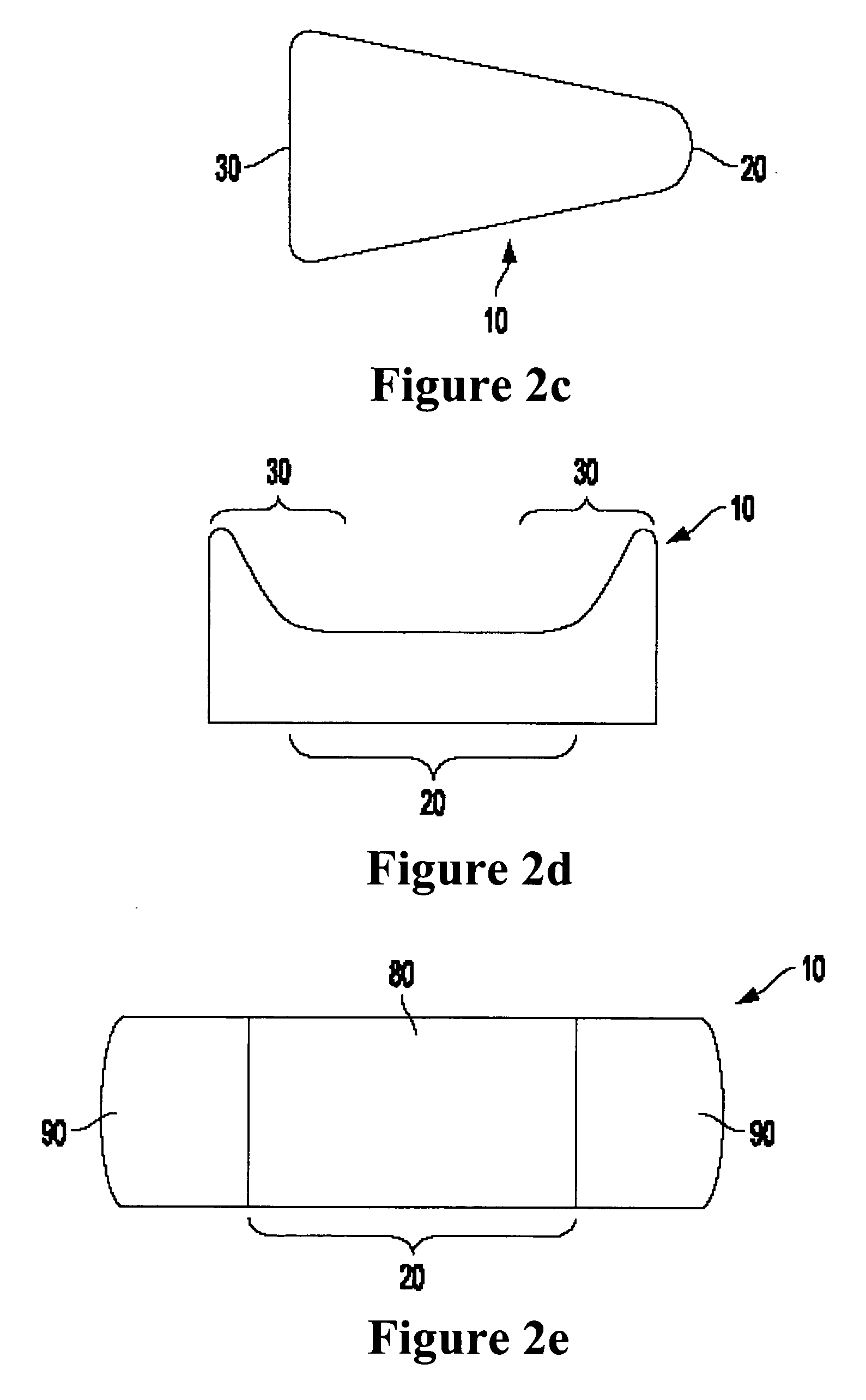 Medical implant and method of reducing back pain