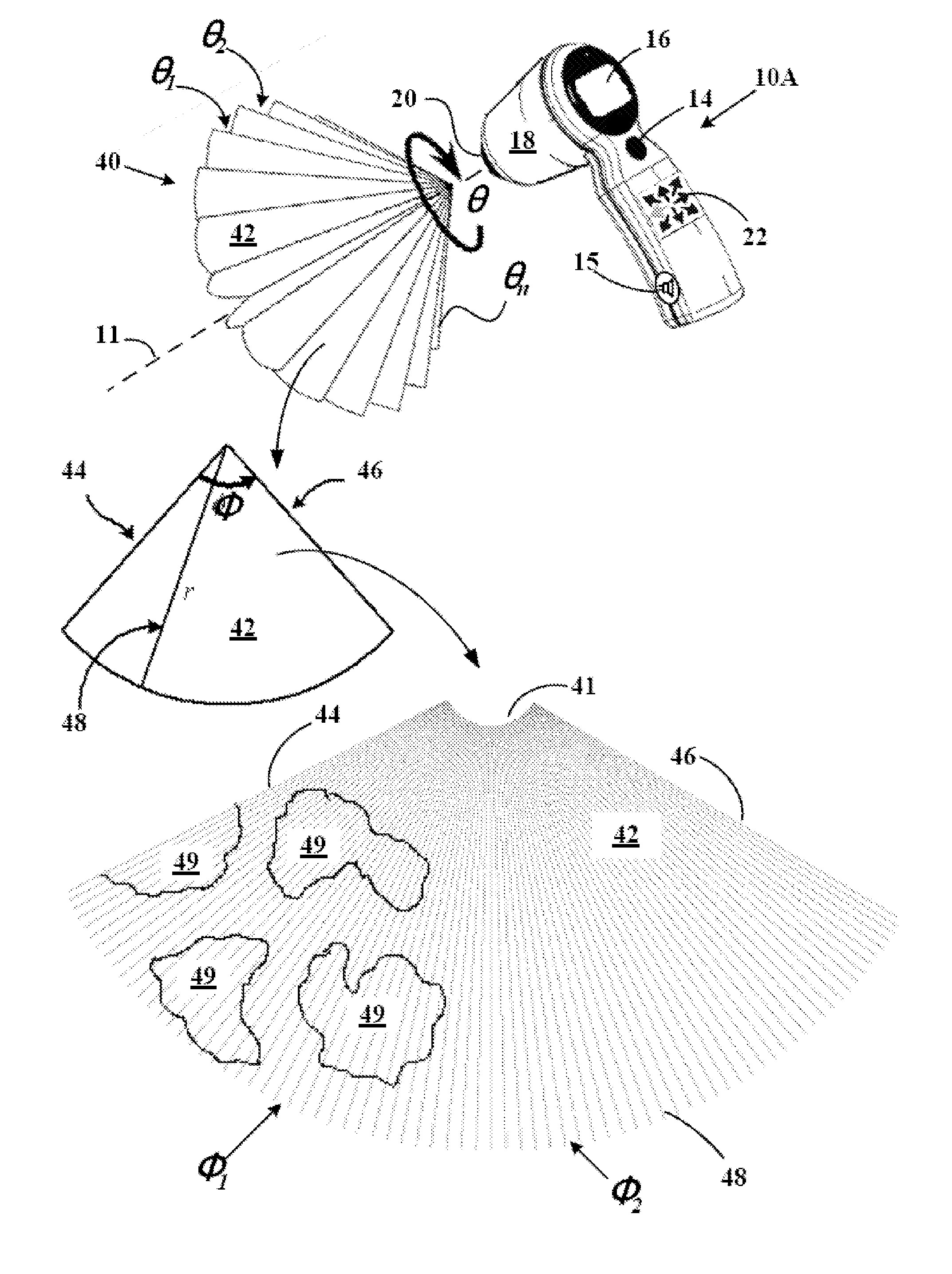 System and method to identify and measure organ wall boundaries