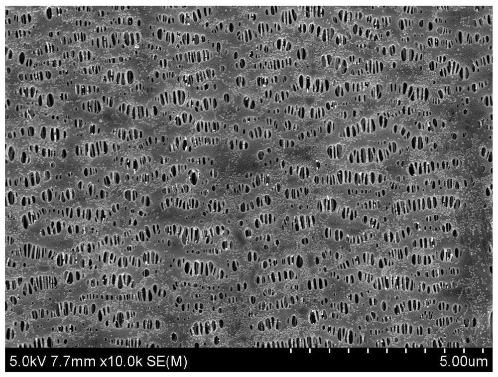 A kind of multilayer polyolefin microporous membrane with asymmetric structure and its preparation method and application