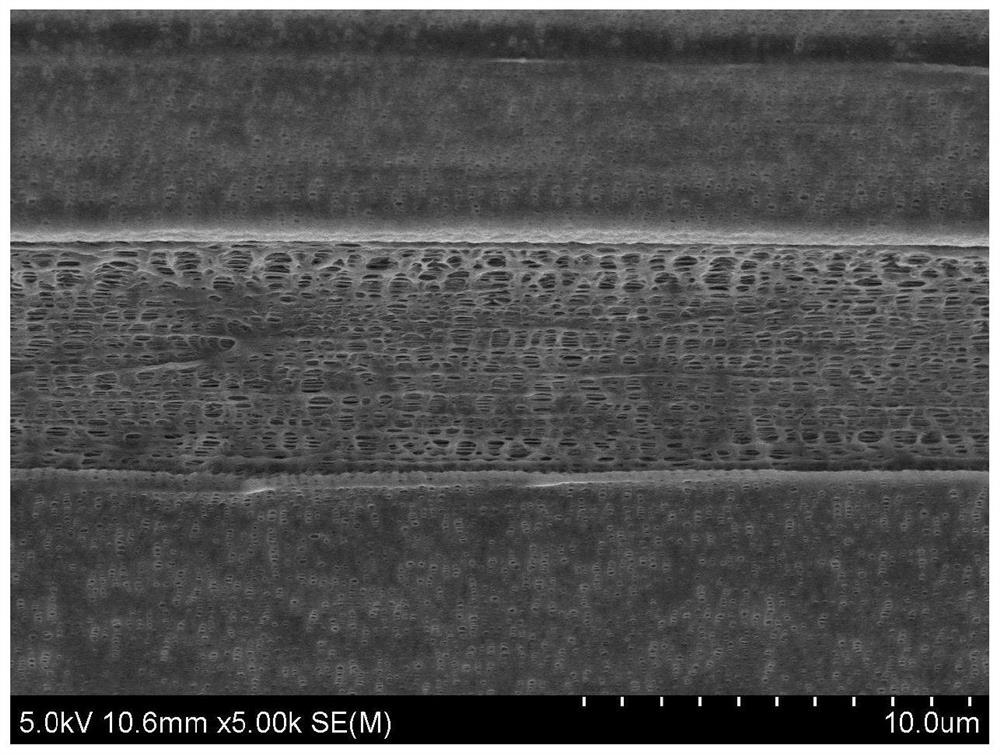 A kind of multilayer polyolefin microporous membrane with asymmetric structure and its preparation method and application