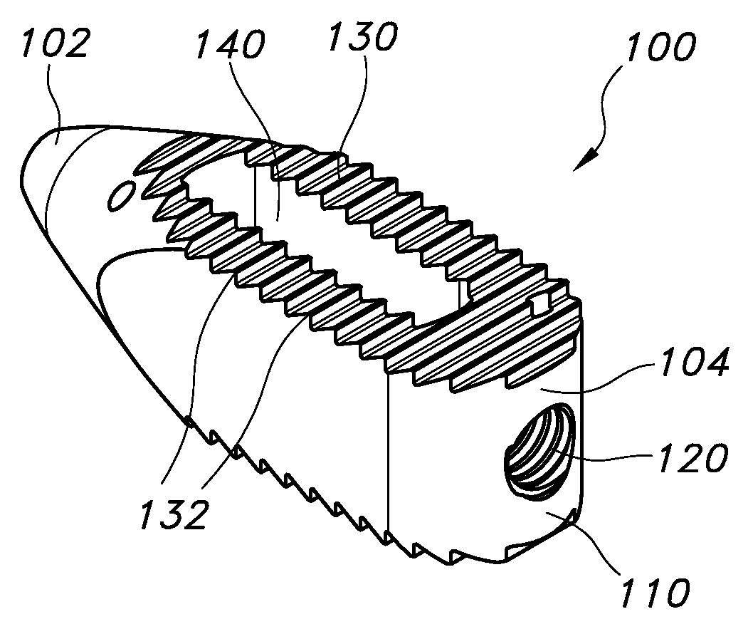 Percutaneous arthrodesis method and system