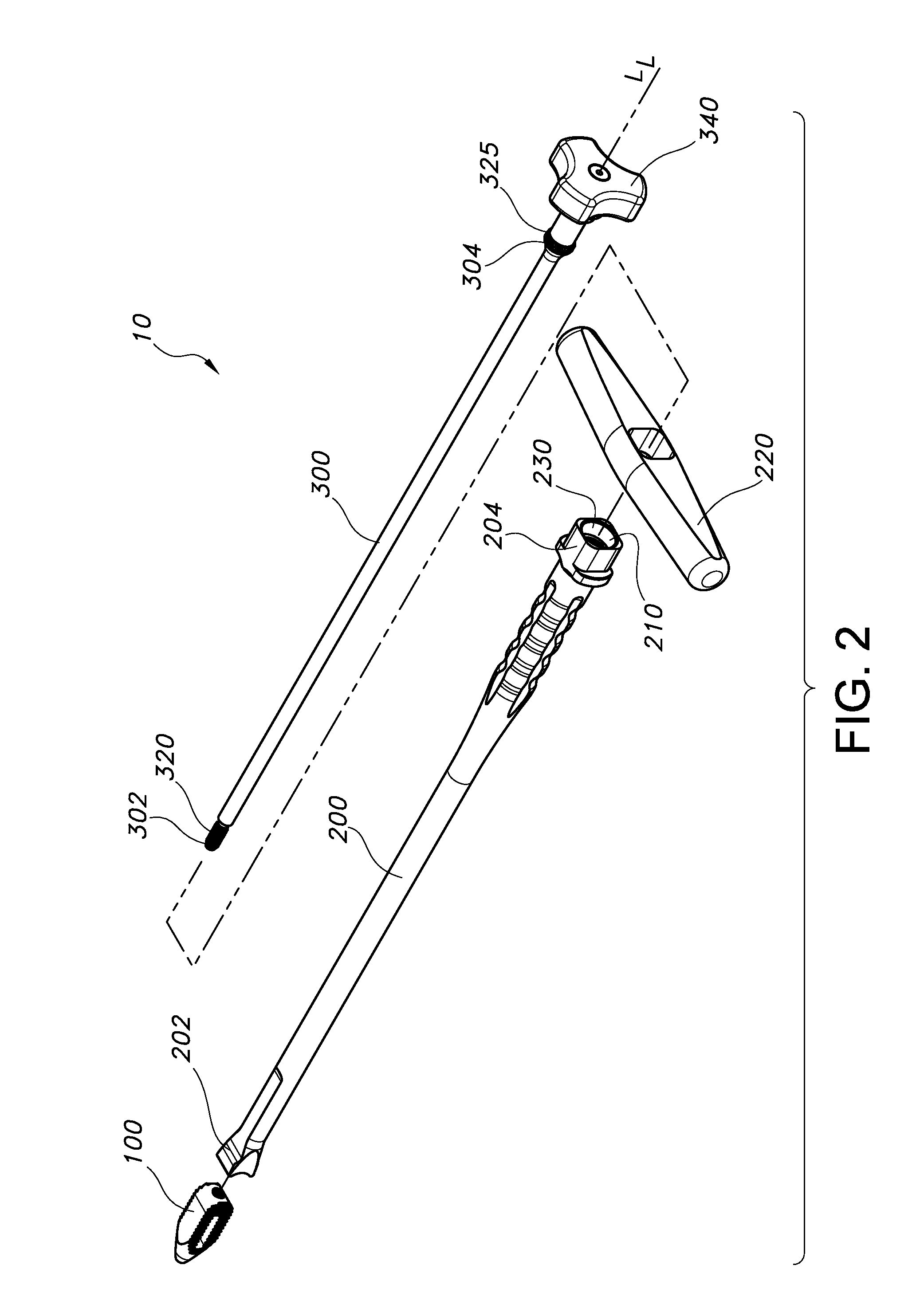 Percutaneous arthrodesis method and system