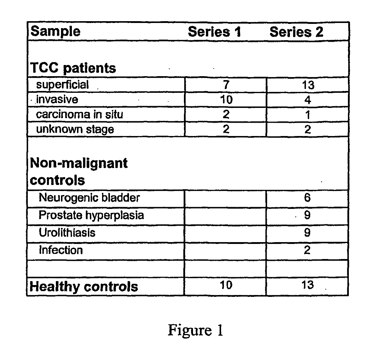 Urine markers for detection of bladder cancer