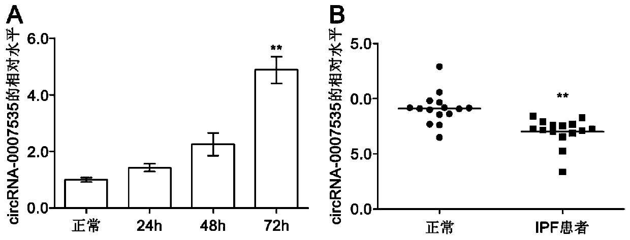 Application of down-regulated circular gene expression reagent in preparing medicine for preventing and/or treating pulmonary fibrosis and down-regulated circular gene expression medicine