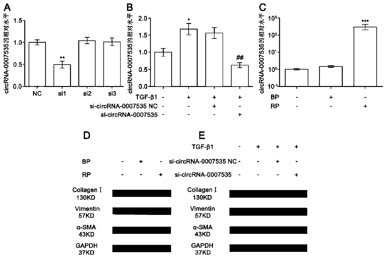 Application of down-regulated circular gene expression reagent in preparing medicine for preventing and/or treating pulmonary fibrosis and down-regulated circular gene expression medicine