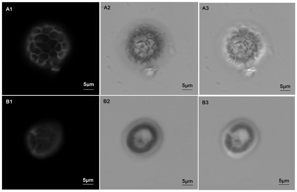 A method for distinguishing teliospores of Tilletia dwarfis and teliospores of Tilletia glabris