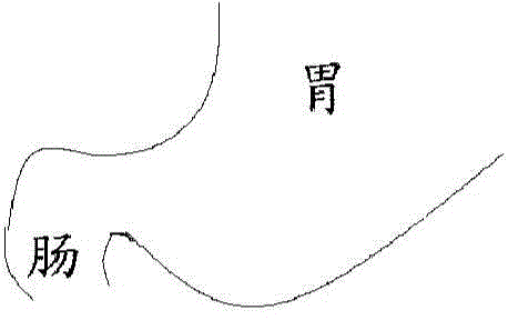 Customized alimentary canal support and moulding method and application method thereof