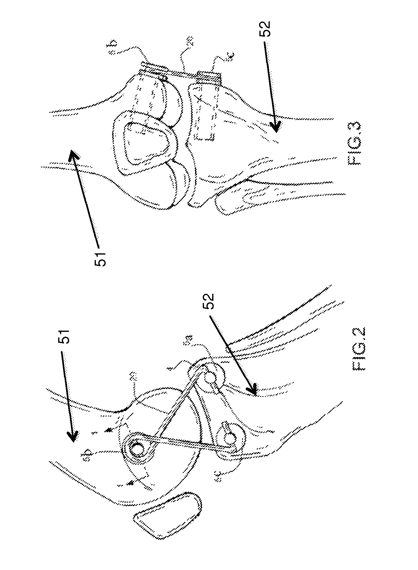 Internal joint bracing system and suture anchoring assembly therefore