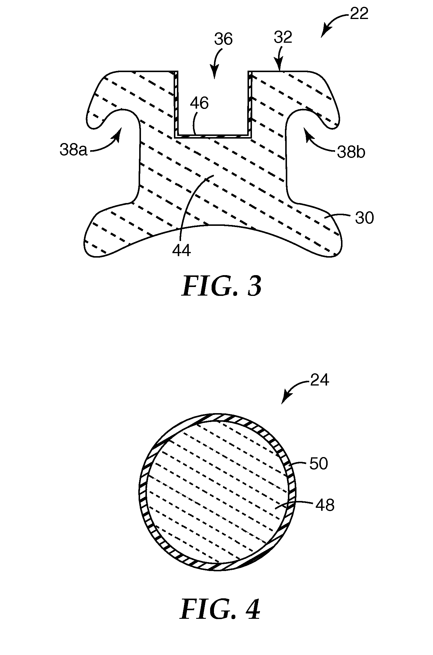 Orthodontic articles with zirconium oxide coatings