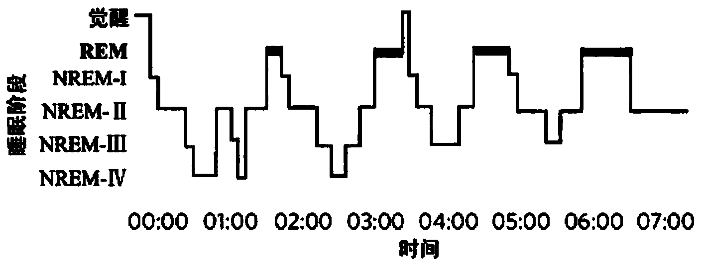 Automatic sleep stage method based on electroencephalogram, heart rate variability and coherence between electroencephalogram and heart rate variability