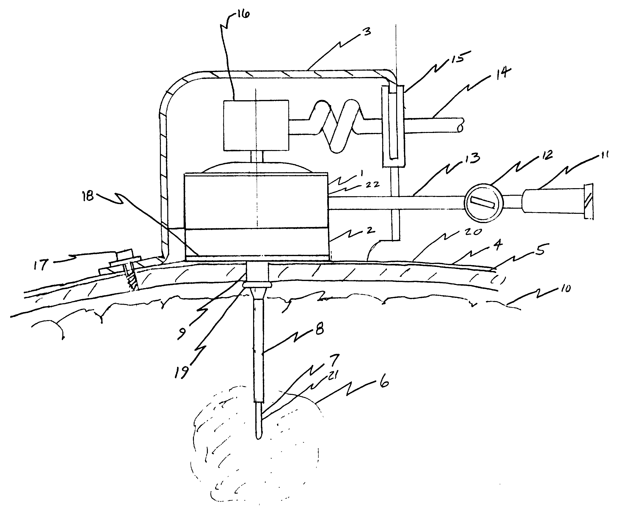 Interstitial brain cooling probe and sheath apparatus