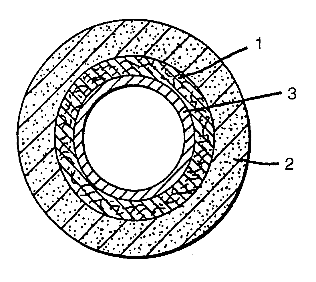 Orthopedic cast system and method