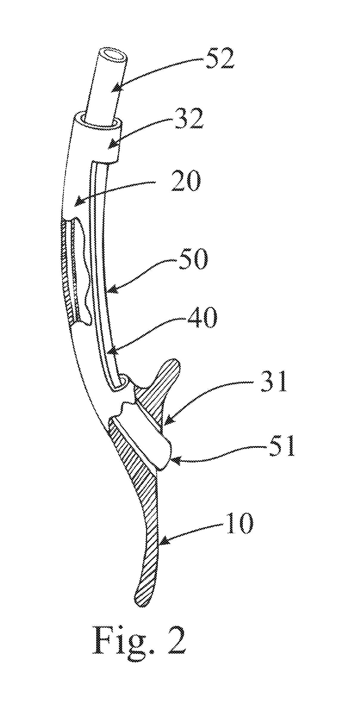 Endotracheal Tube Insertion Device