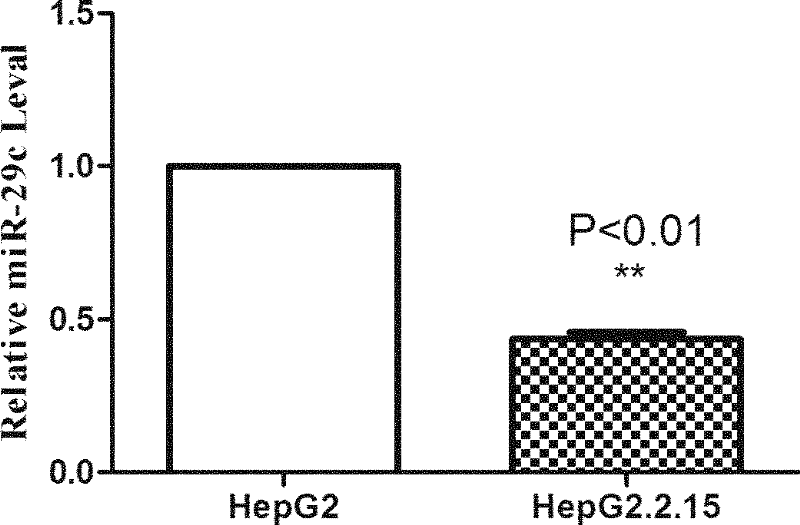 Application of micromolecule RNA has-miR-29c in preparing medicine treating liver cancer