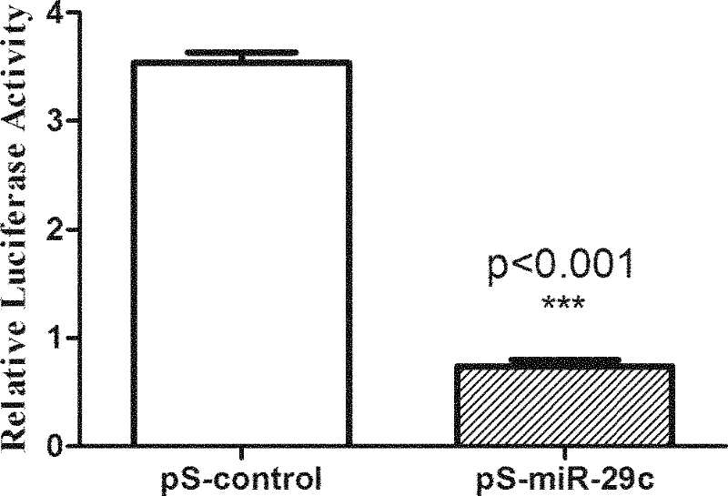 Application of micromolecule RNA has-miR-29c in preparing medicine treating liver cancer