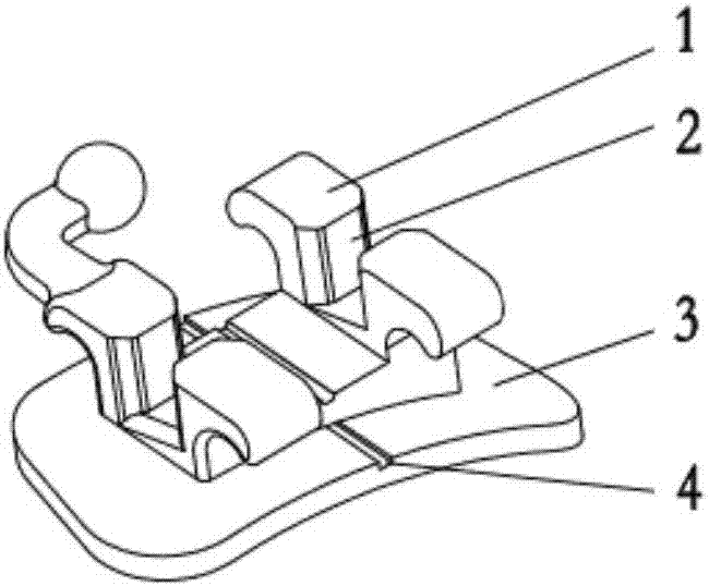 Wx series bracket and buccal tube