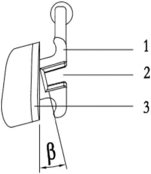 Wx series bracket and buccal tube