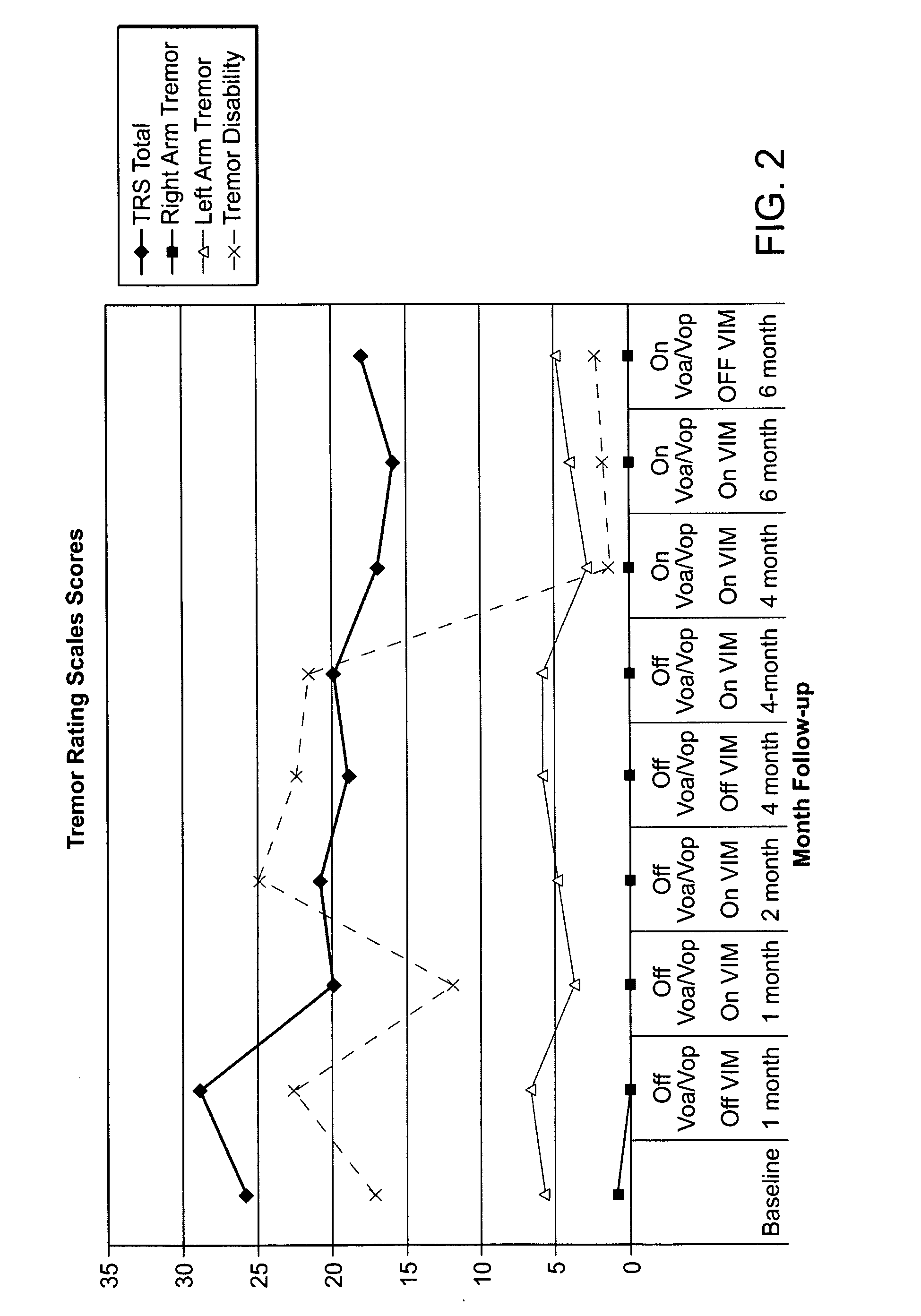 Multiple lead method for deep brain stimulation