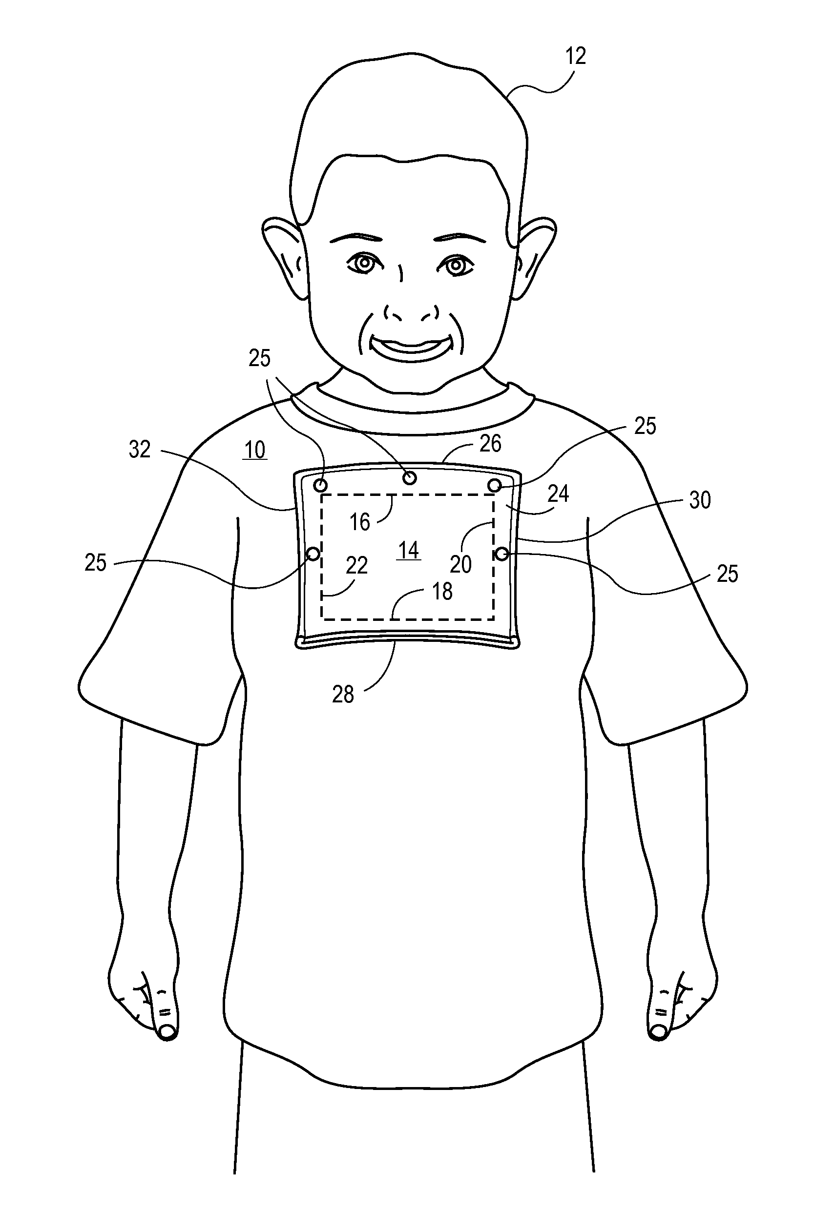 Medical Garment and Method