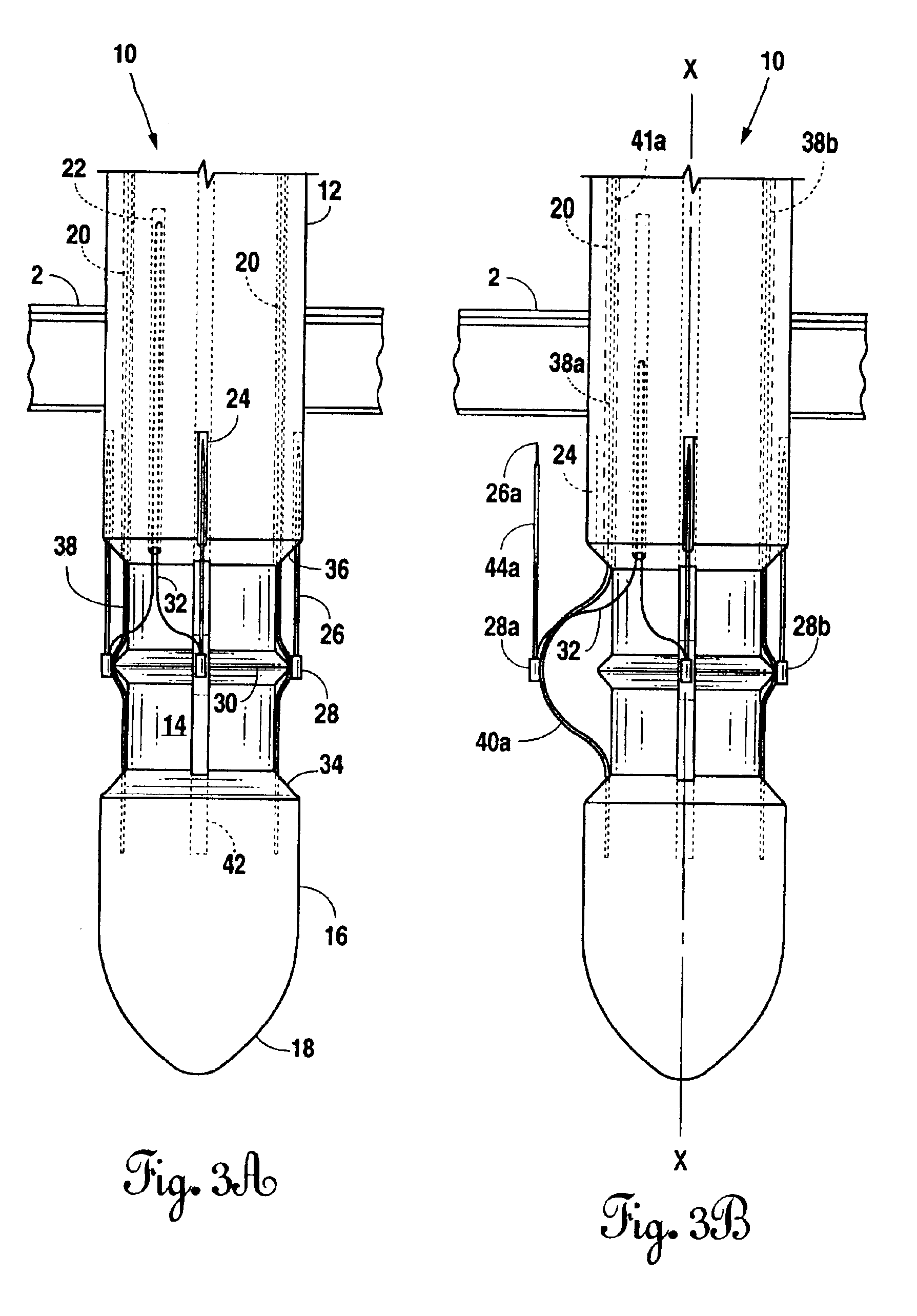 Suture device