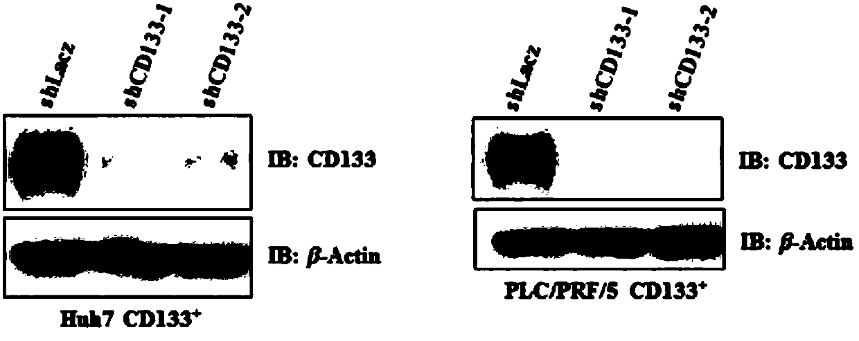 Application of stem cell marker CD133 interference nucleic acid to preparation of tumor proliferation restraining preparation