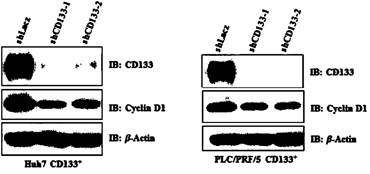 Application of stem cell marker CD133 interference nucleic acid to preparation of tumor proliferation restraining preparation