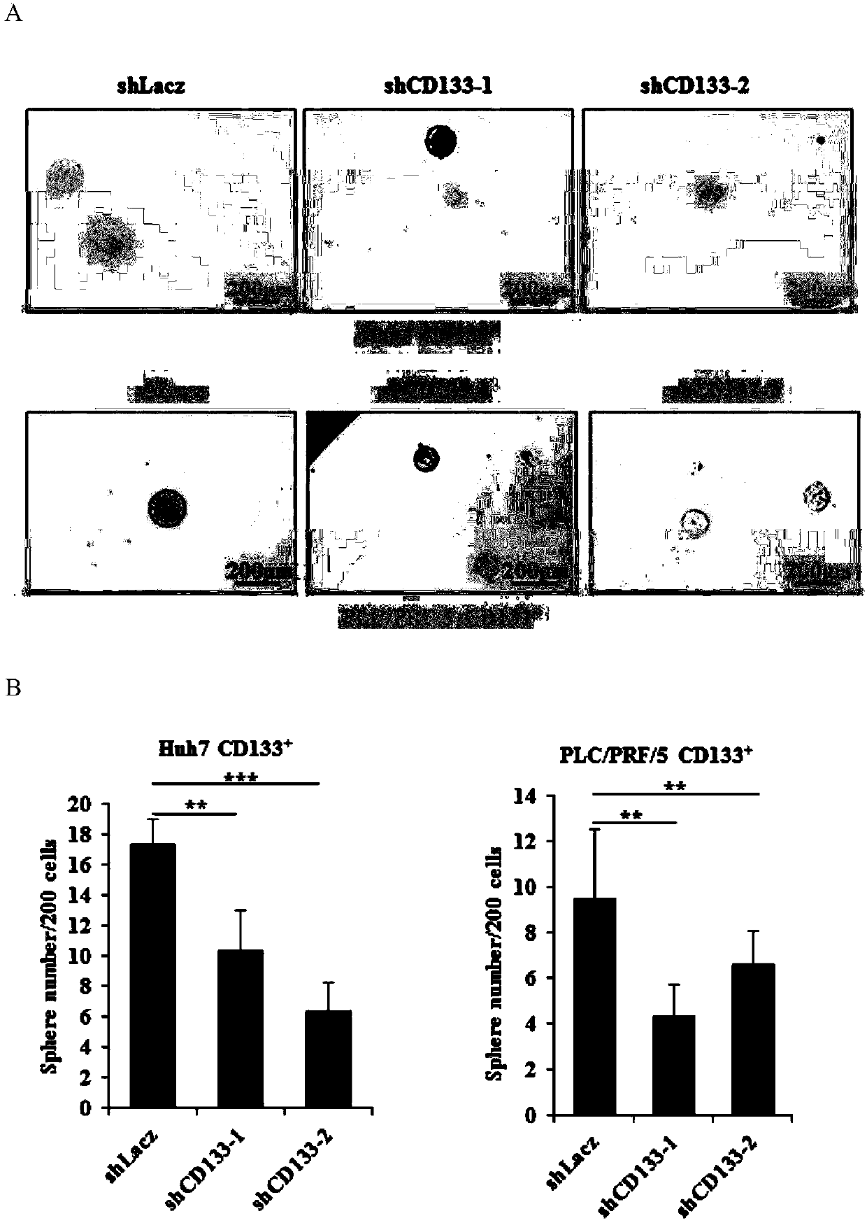 Application of stem cell marker CD133 interference nucleic acid to preparation of tumor proliferation restraining preparation