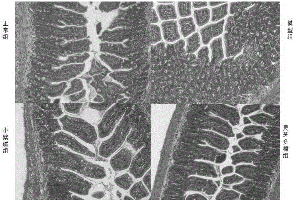 Purpose of ganoderan in preparation of health food for regulating flora in intestinal tract