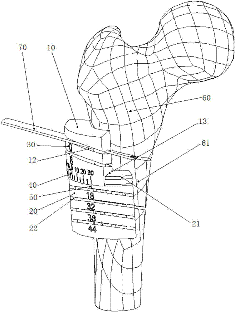 Rotary bone-cutting guide plate with precise measurement