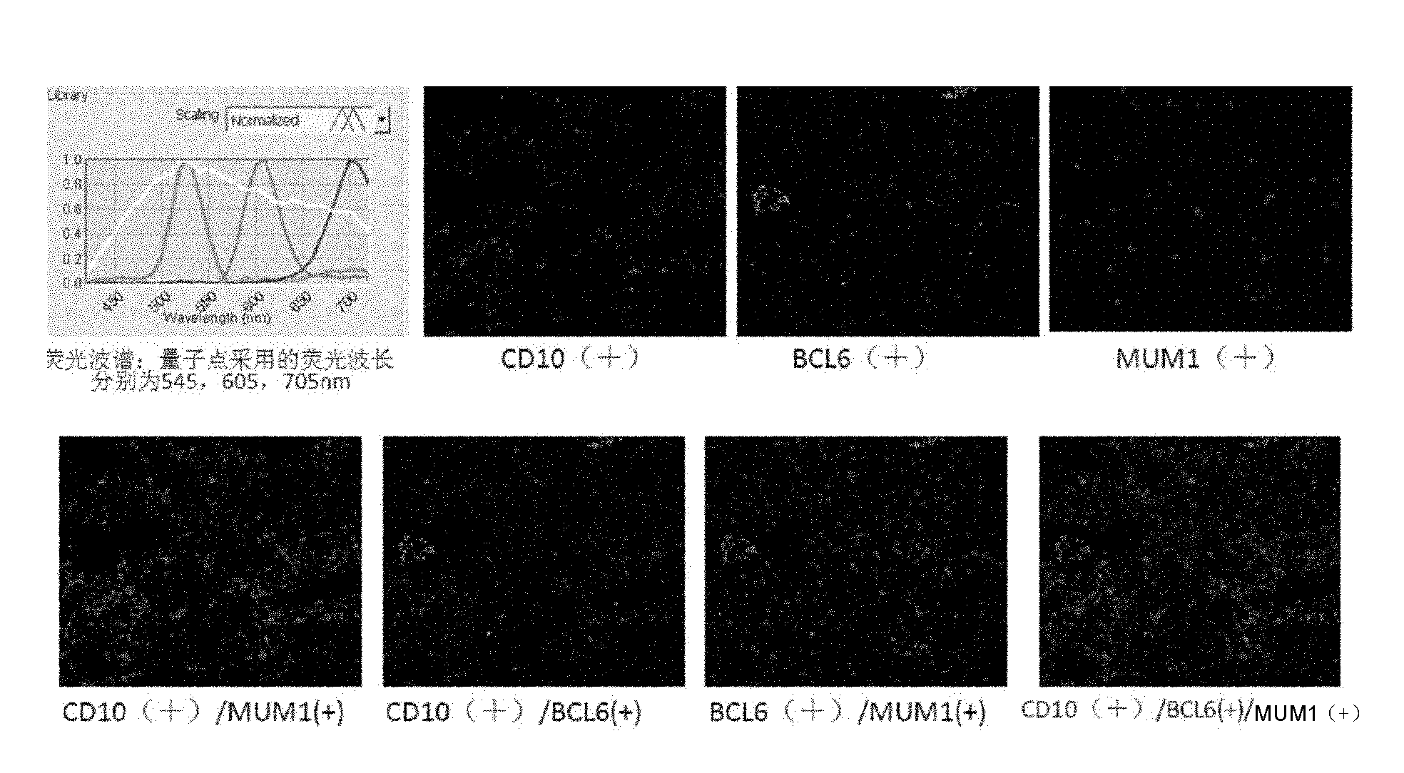 Molecular pathological classification method of diffuse large B-cell lymphomata, kit and application thereof