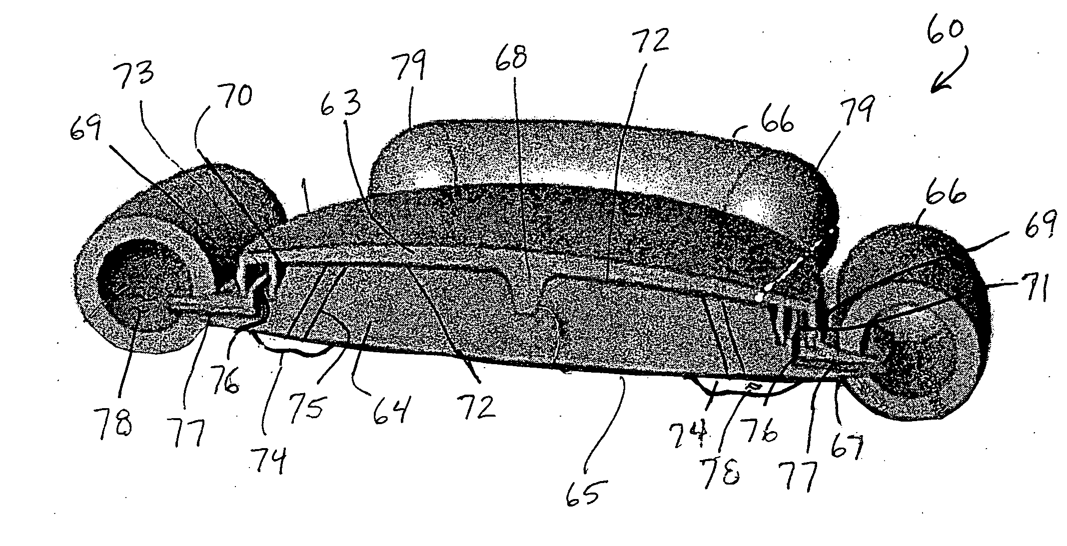 Accommodating intraocular lens having peripherally actuated deflectable surface and method