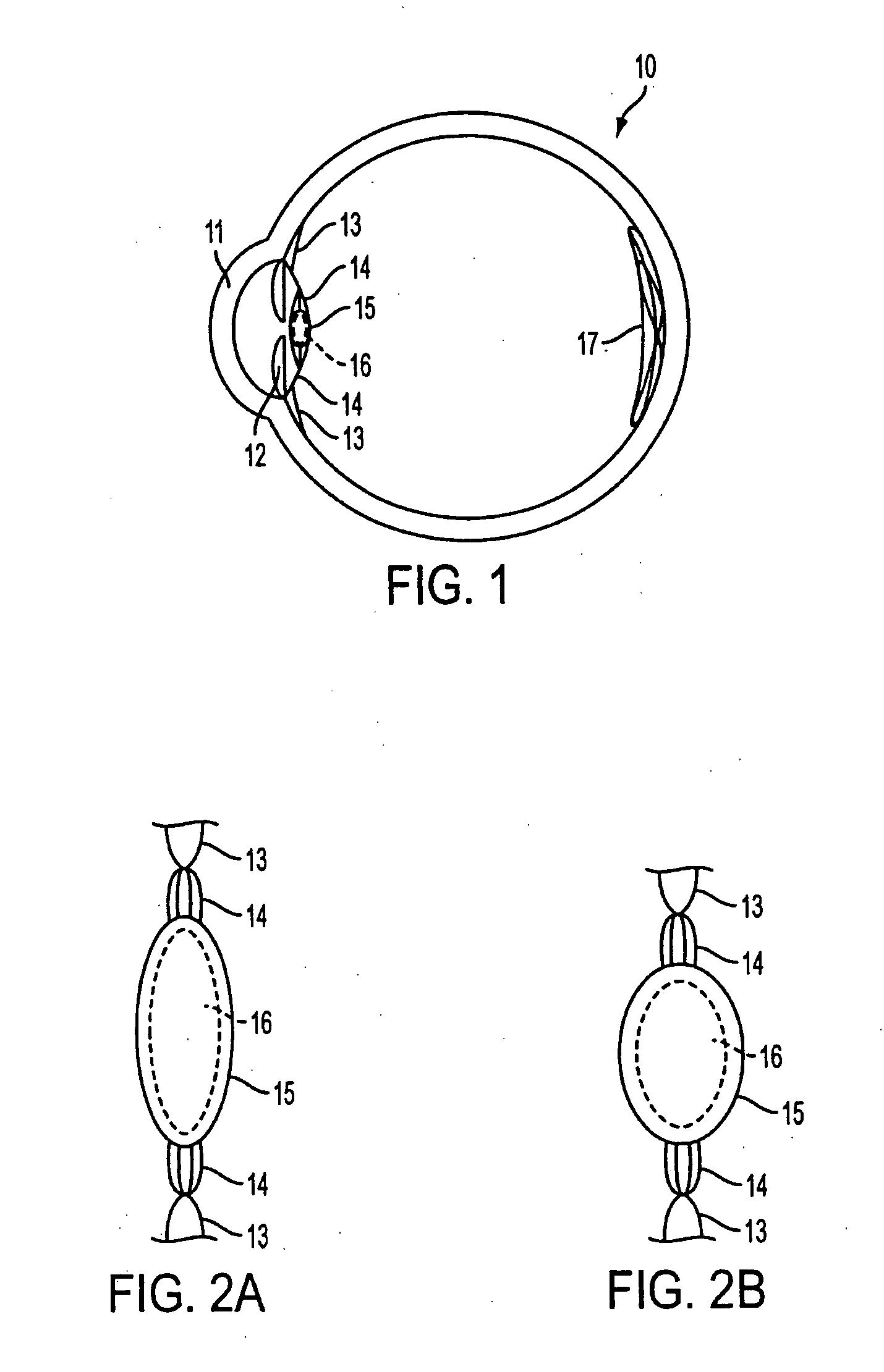 Accommodating intraocular lens having peripherally actuated deflectable surface and method