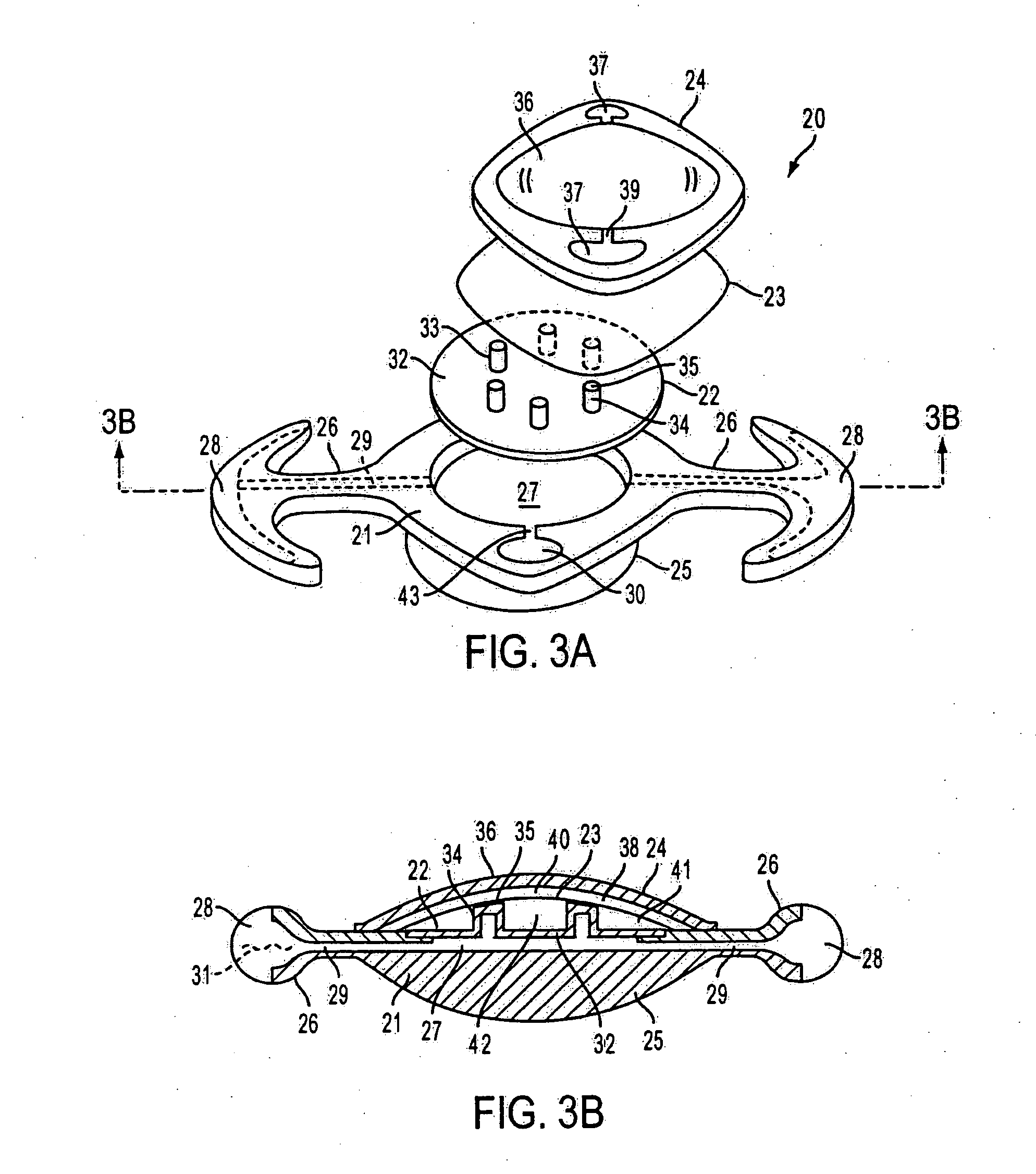 Accommodating intraocular lens having peripherally actuated deflectable surface and method