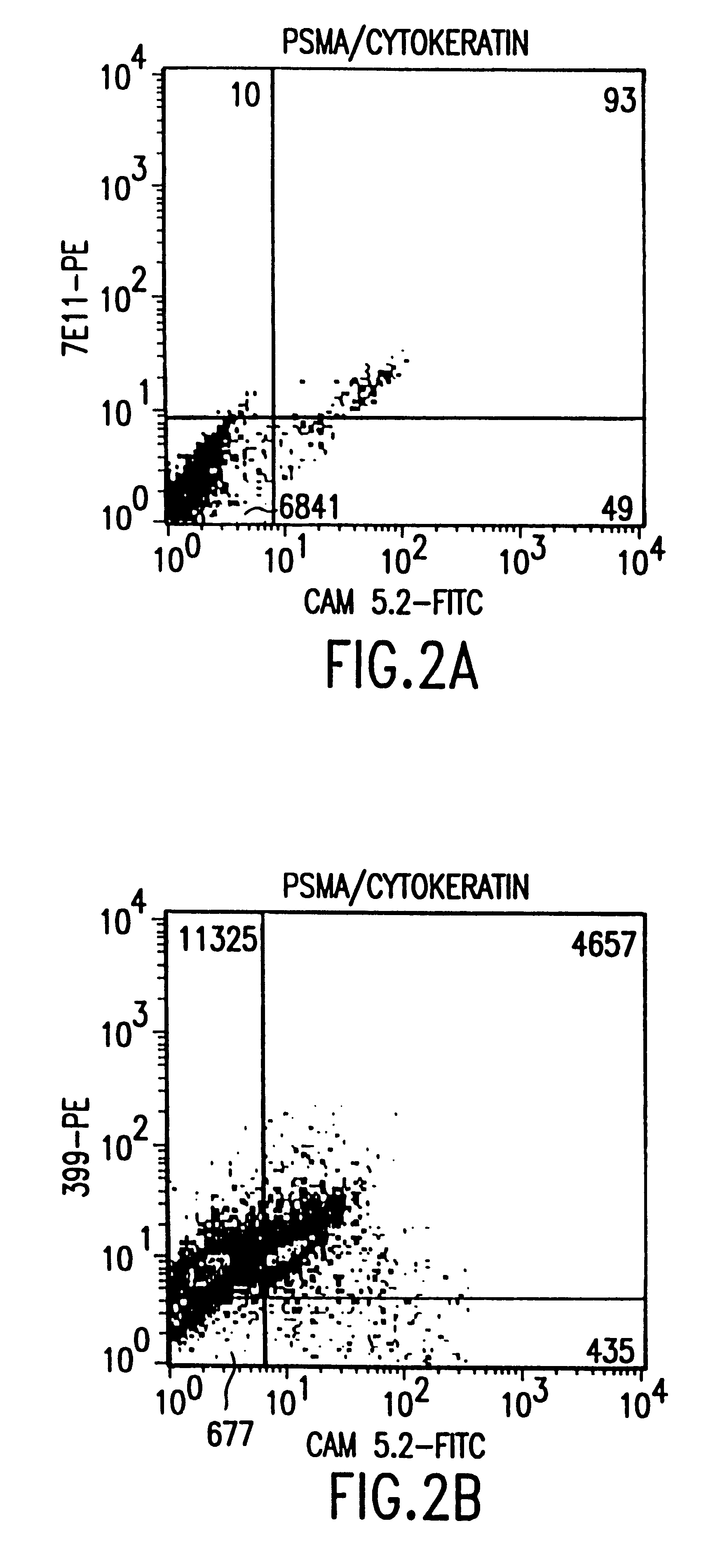 Non-invasive methods to detect prostate cancer