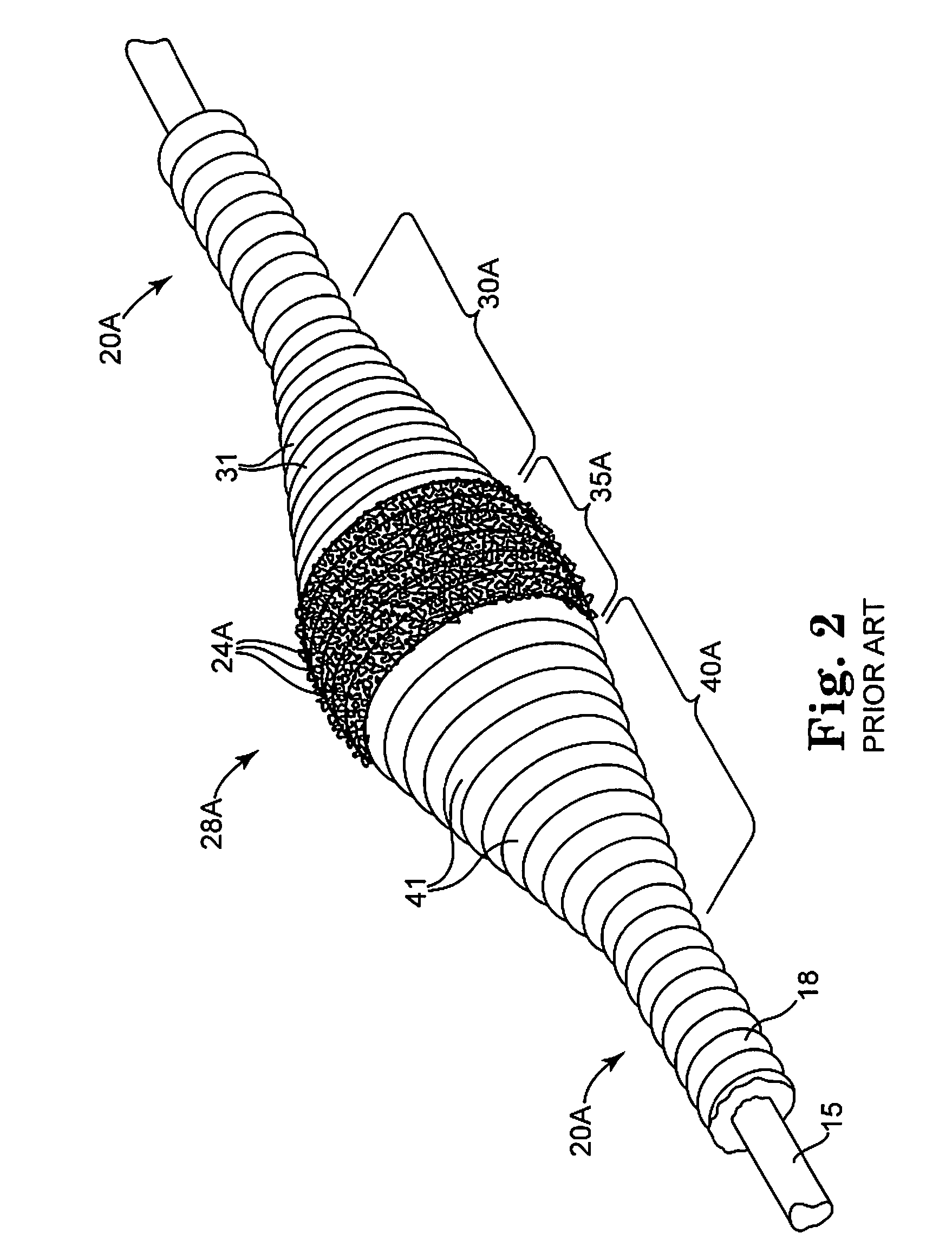 Rotational atherectomy segmented abrading head and method to improve abrading efficiency