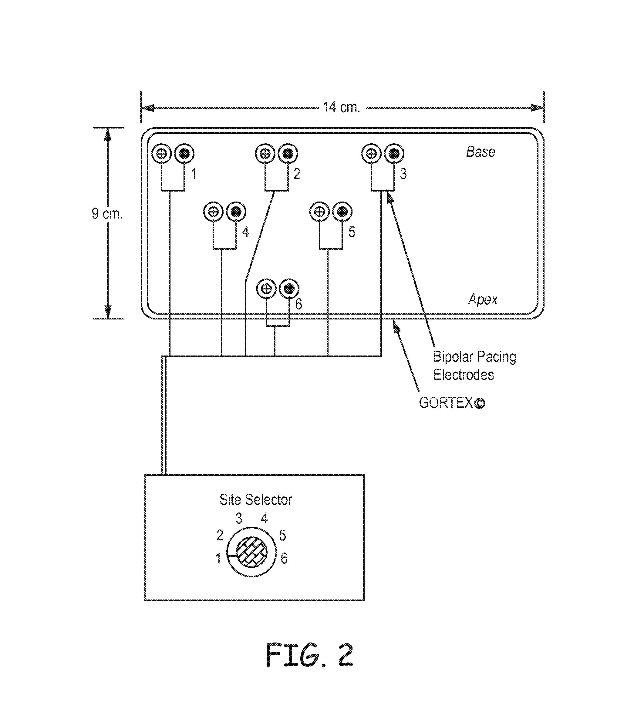 Methods for optimization of biventricular pacing devices and systems useful therefor