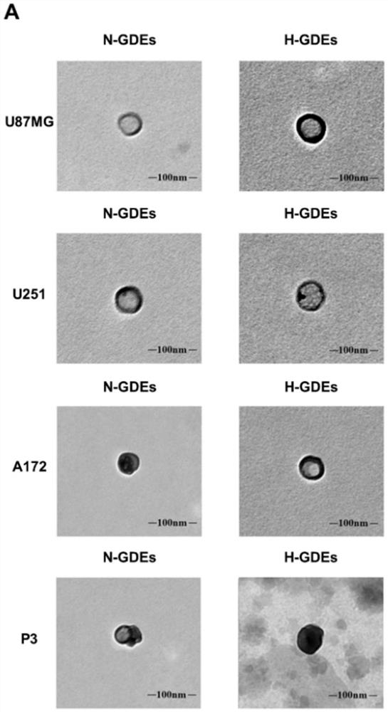 Application of mir-1246 and/or terf2ip in the diagnosis and treatment of glioma