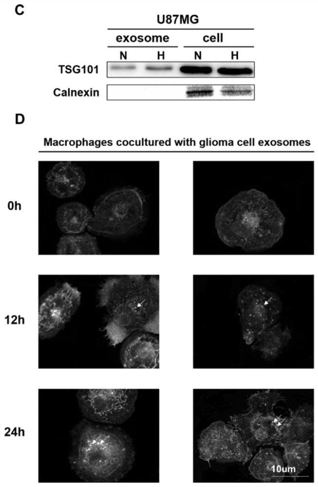 Application of mir-1246 and/or terf2ip in the diagnosis and treatment of glioma