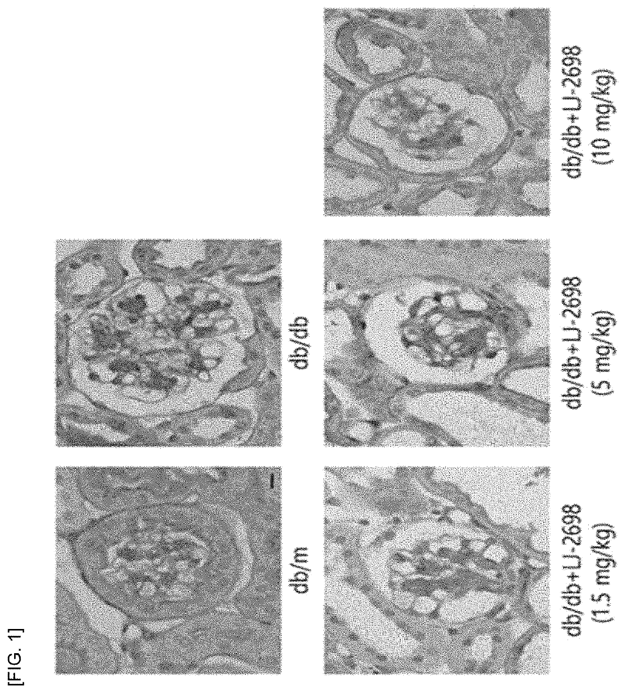 Pharmaceutical composition for preventing and treating diabetic nephropaphy including adenosine derivative