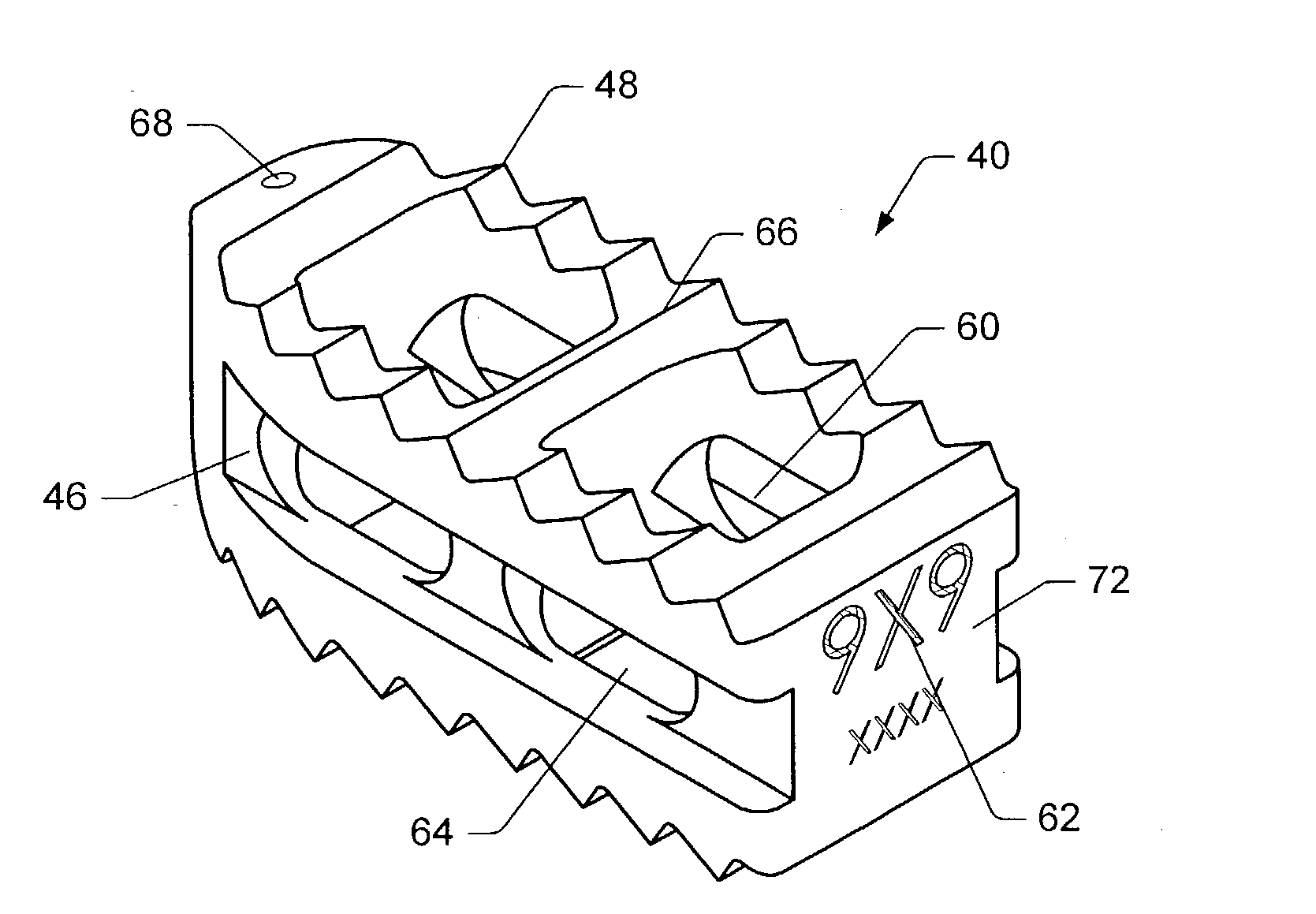 Spinal implant